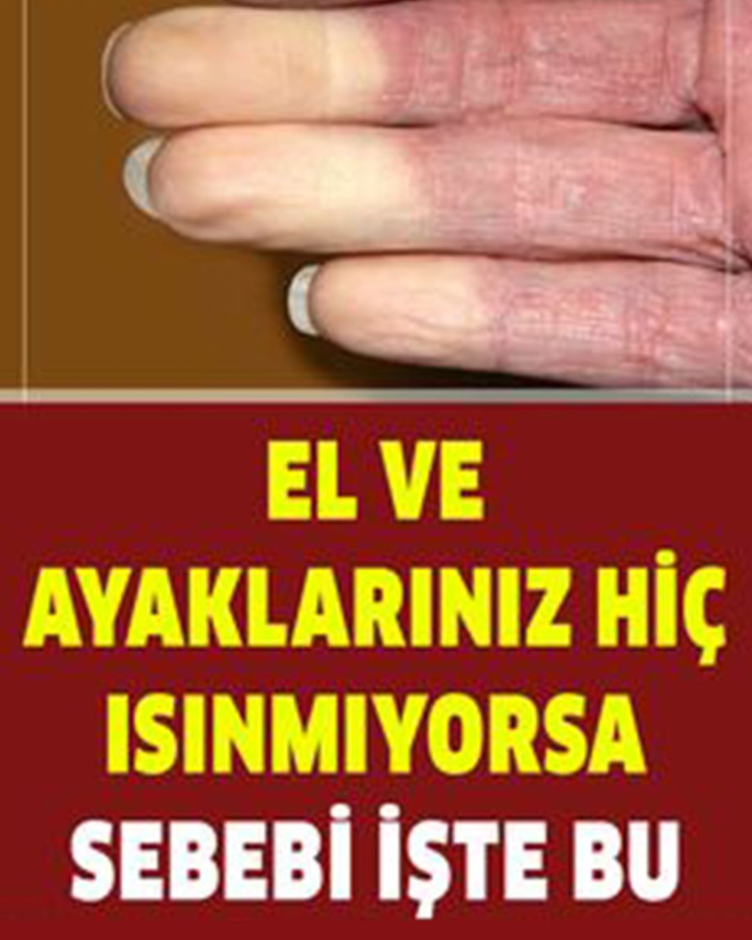 El ve Ayaklarınız Hiç Isınmıyorsa Sebebi - 1