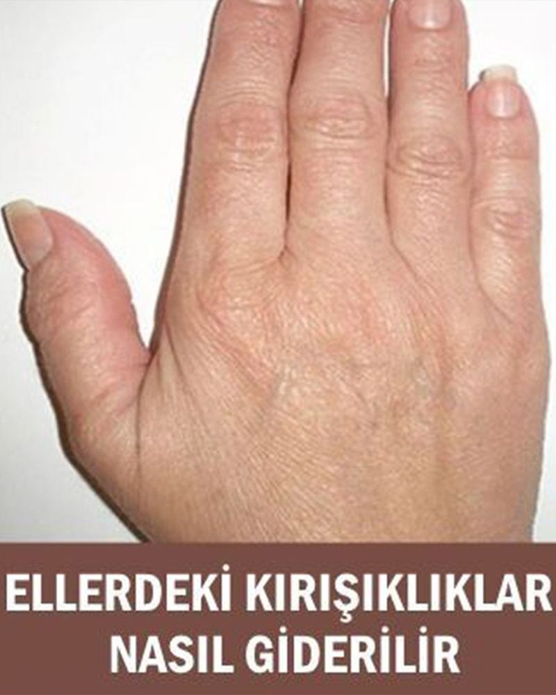 El Kırışıklıklarını Bitiren Doğal Yöntem - 1