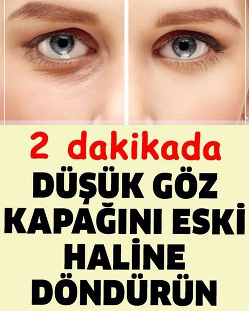 Düşük Göz Kapağını Eski Haline Getirmenin Püf Noktası - 1