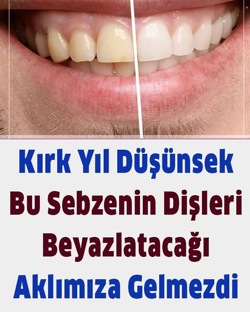 Dişleri beyazlatan sebzeler - 1