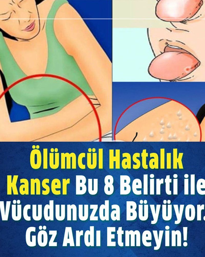 Kanserin Vücuda Verdiği 8 Belirti - 1