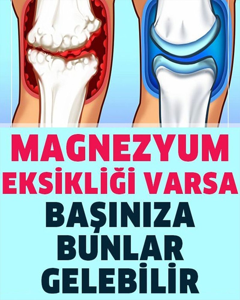Vücudunuzda Magnezyum Eksikliğinin 13 Belirtisi - 1