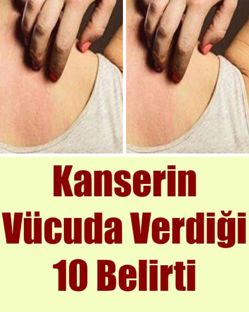 Kanserin Vücuda Verdiği 10 Belirti - 1