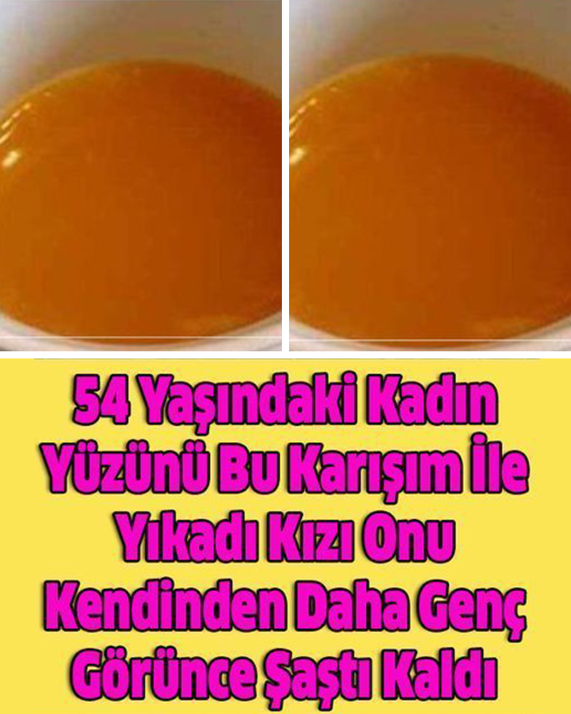 Bu Karışım İle Yıkadı Yüzünü Görünce Şaştı Kaldı - 1