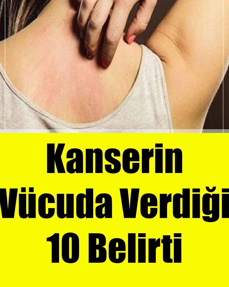 Kanserin Vücuda Verdiği 10 Belirti - 1