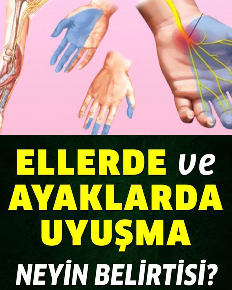 El ve ayak uyuşması neyin belirtisi - 1