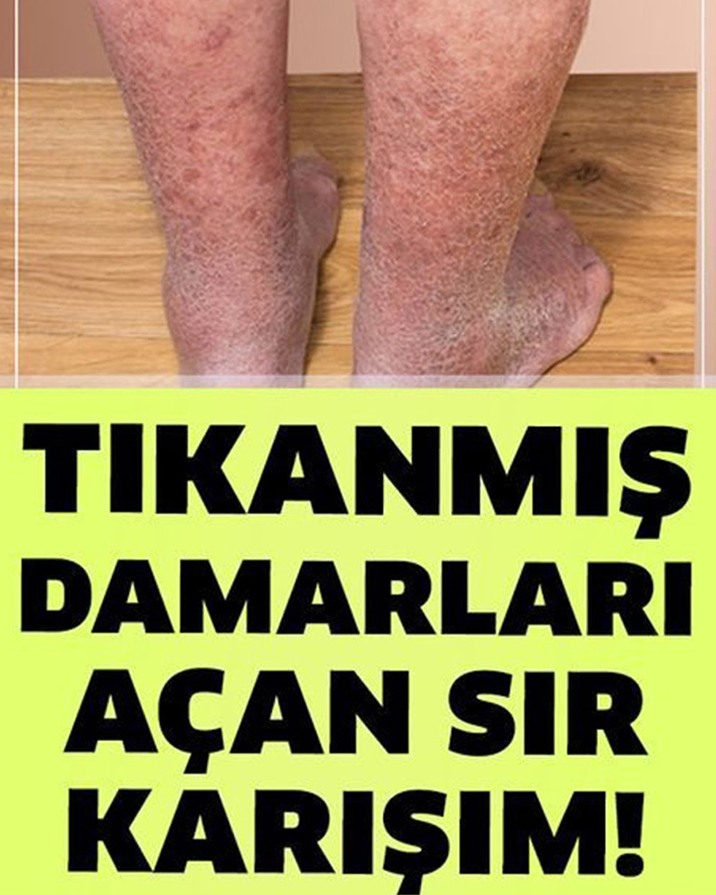 Damarlarınızı Tertemiz Yapacak Sır - 1