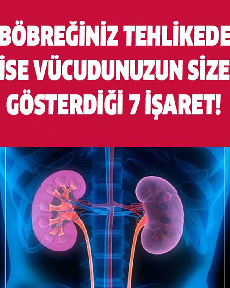 Böbreğiniz tehlikede ise, vücut size bu 7 işareti verecek - 1