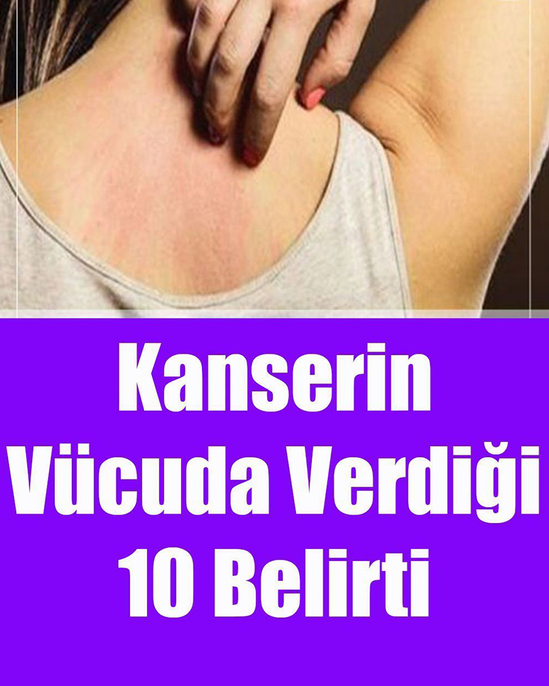 Kanserin Vücuda Verdiği 10 Belirti - 1