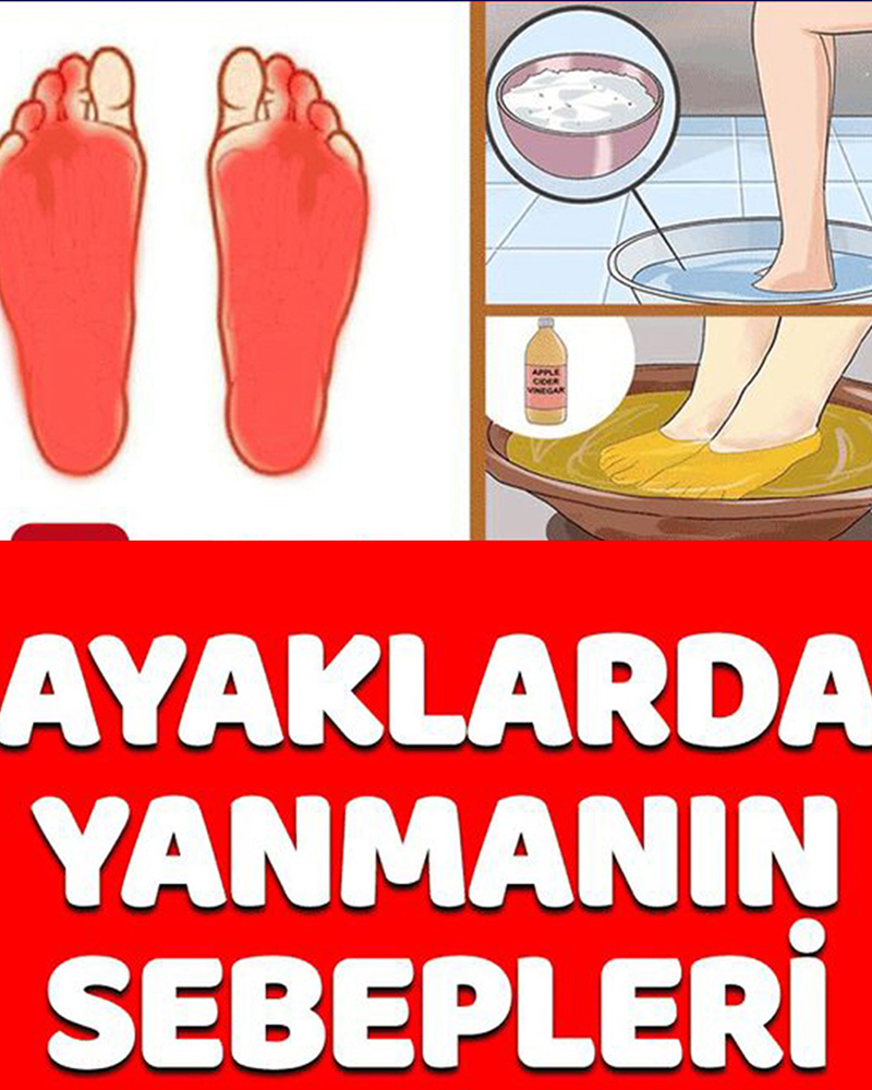 Ayaklarda Yanma Sebepleri - 1