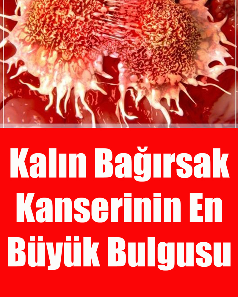Kalın Bağırsak Kanserinin En Büyük Belirtisi Bu - 1