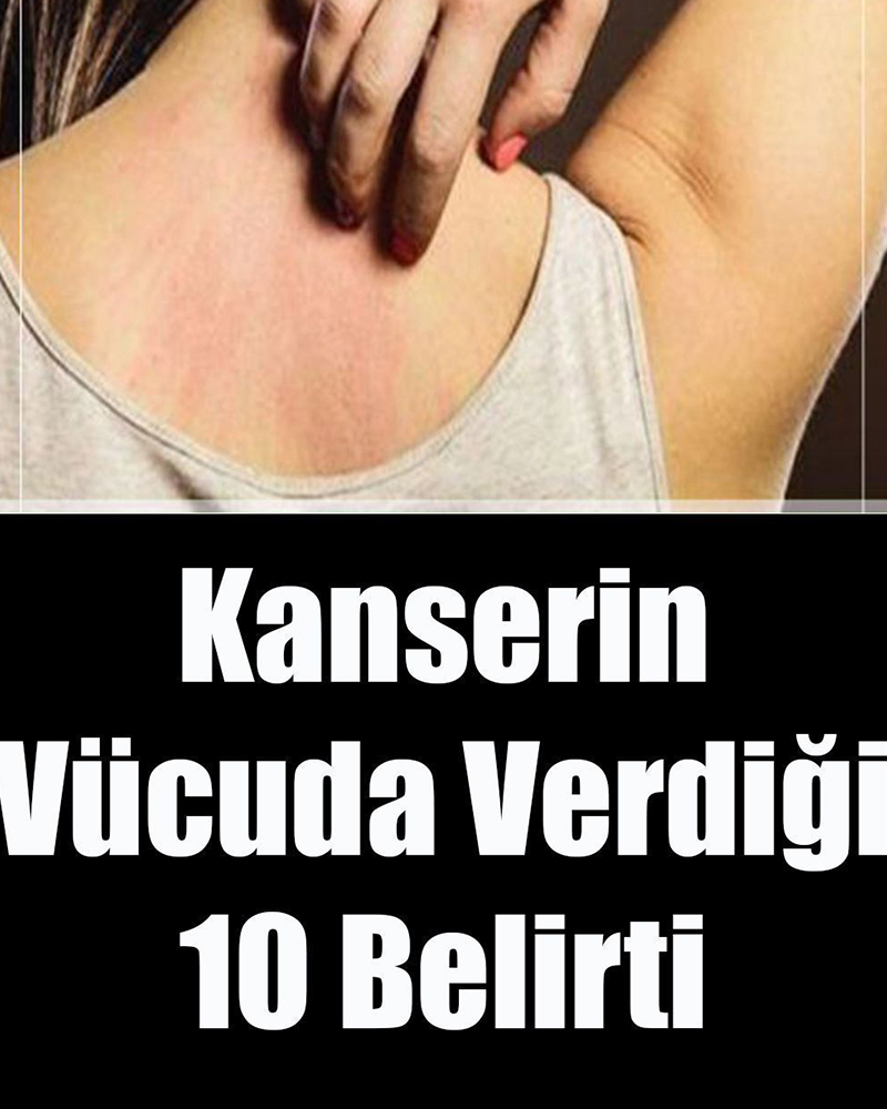 Kanserin Vücuda Verdiği 10 Belirti - 1