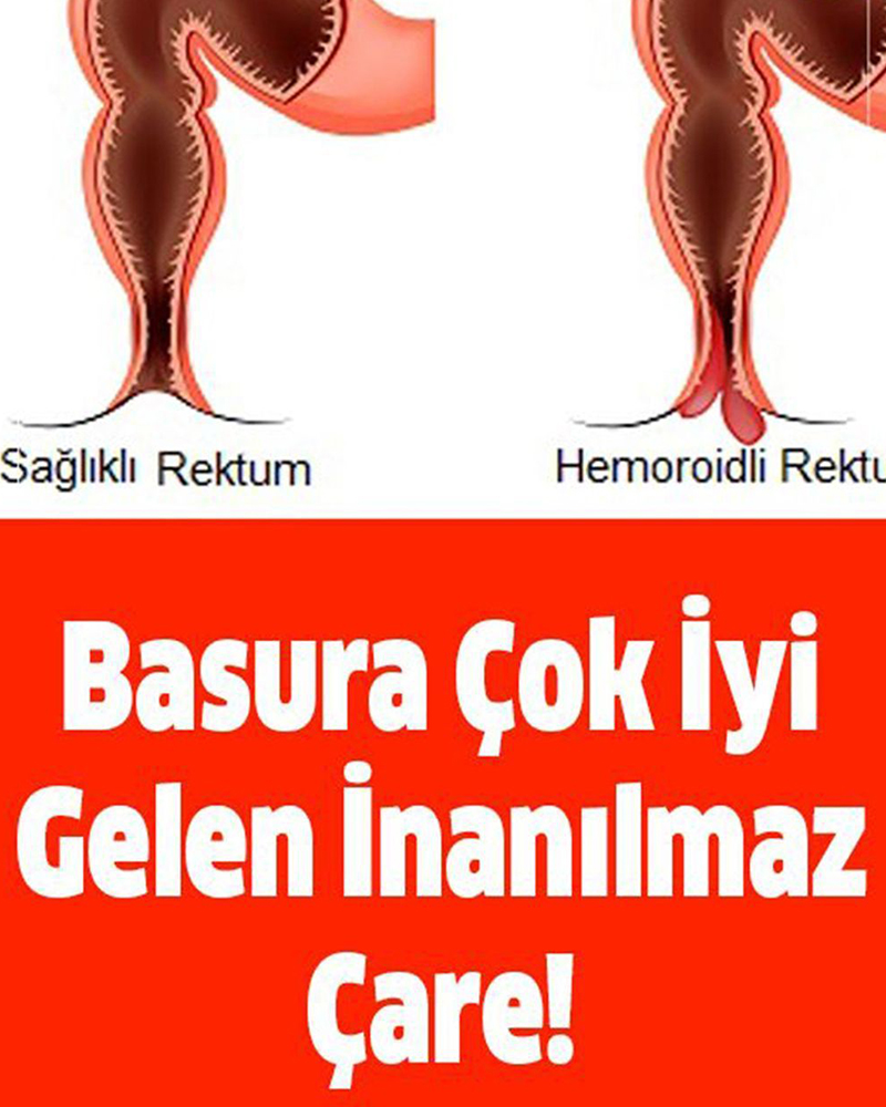 Basura iyi gelen inanılmaz yöntem - 1