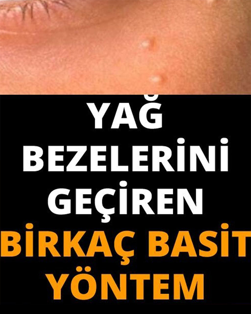 Yağ Bezelerini Geçirmenin En Etkili Yolları - 1