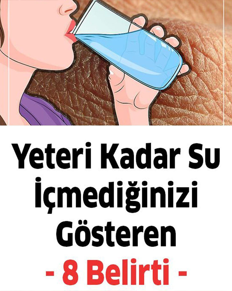 Yeteri kadar su içmediğinizde başınıza bunlar gelir - 1