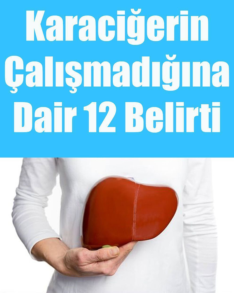 Karaciğerin Çalışmadığına Gösteren 12 Belirti - 1