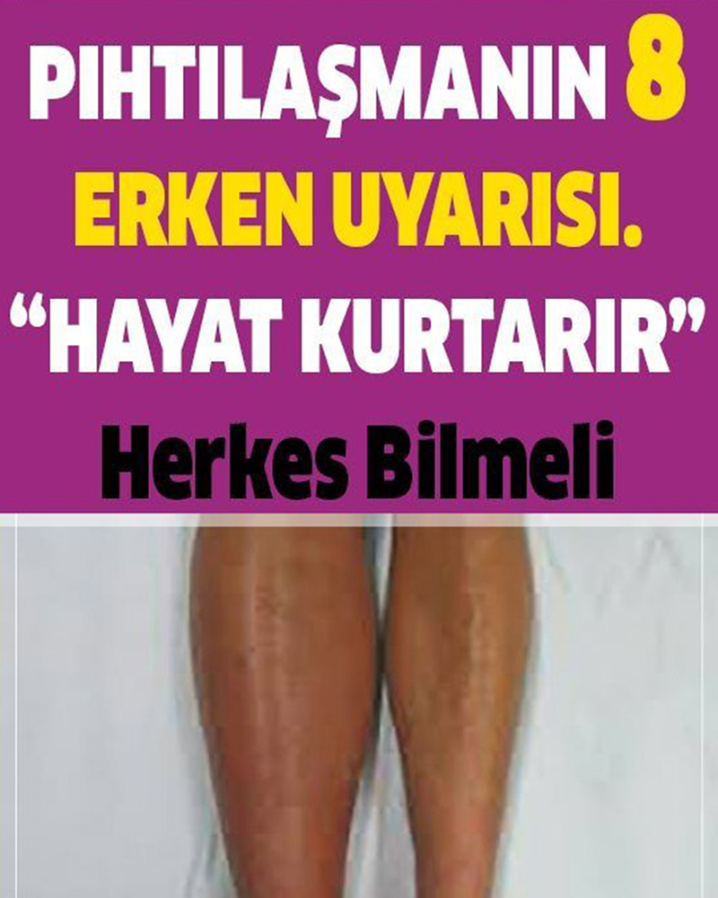 Pıhtılaşmanın 8 Erken Belirtisi - 1