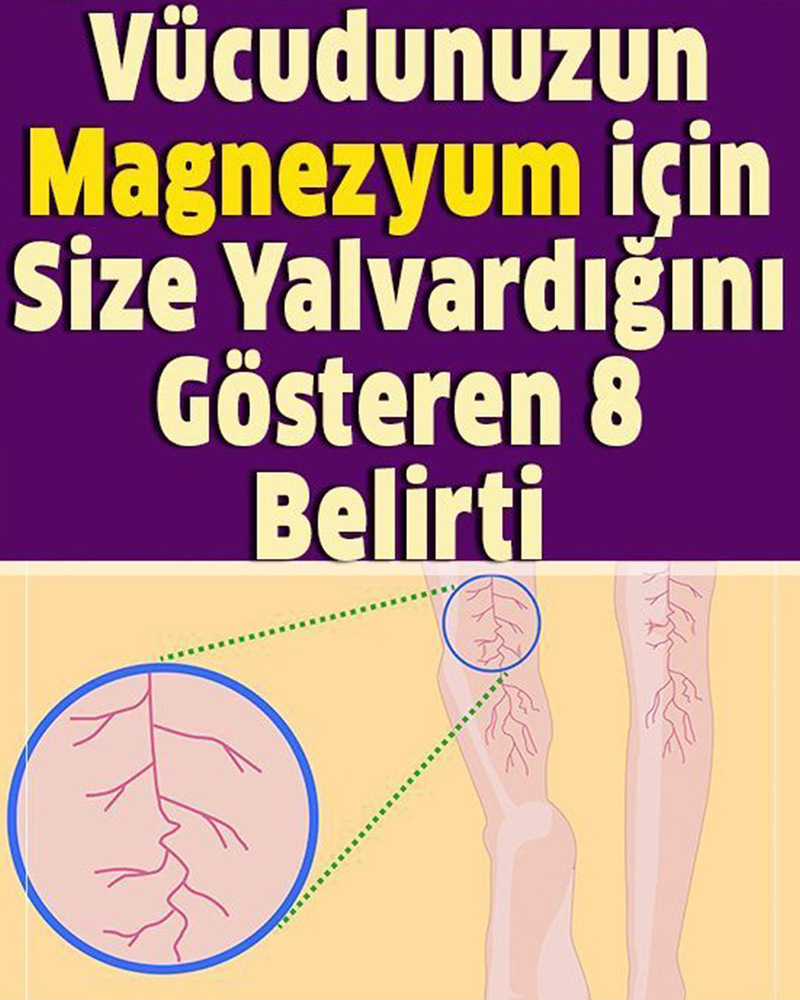 Vücudunuzda Magnezyum Eksikliğini Gösteren 8 Belirtisi - 1