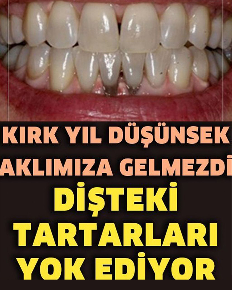 Evde Tartar Lekelerinden Nasıl Kurtulursunuz? - 1