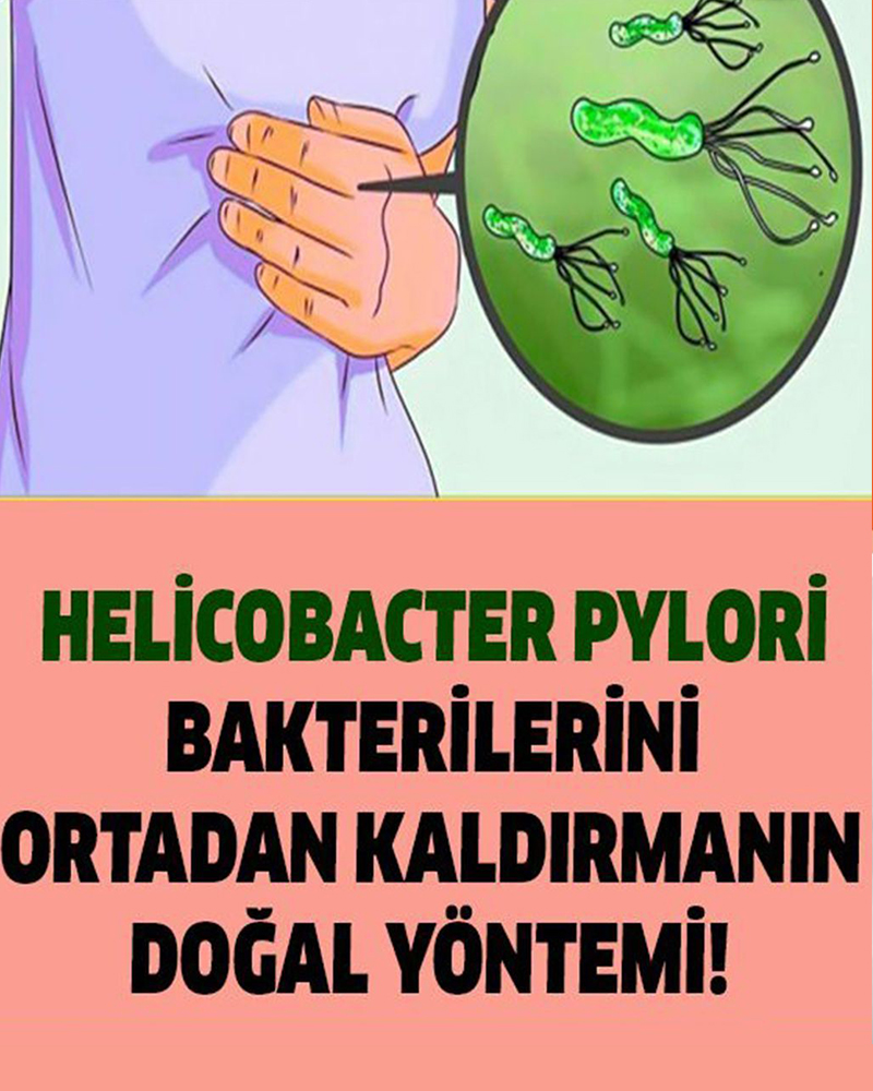 Mideden Bakterileri Ortadan Kaldırmanın Doğal Yöntemi - 1