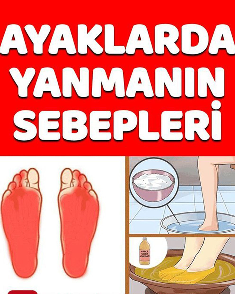 Ayaklarda Yanma Sebepleri - 1