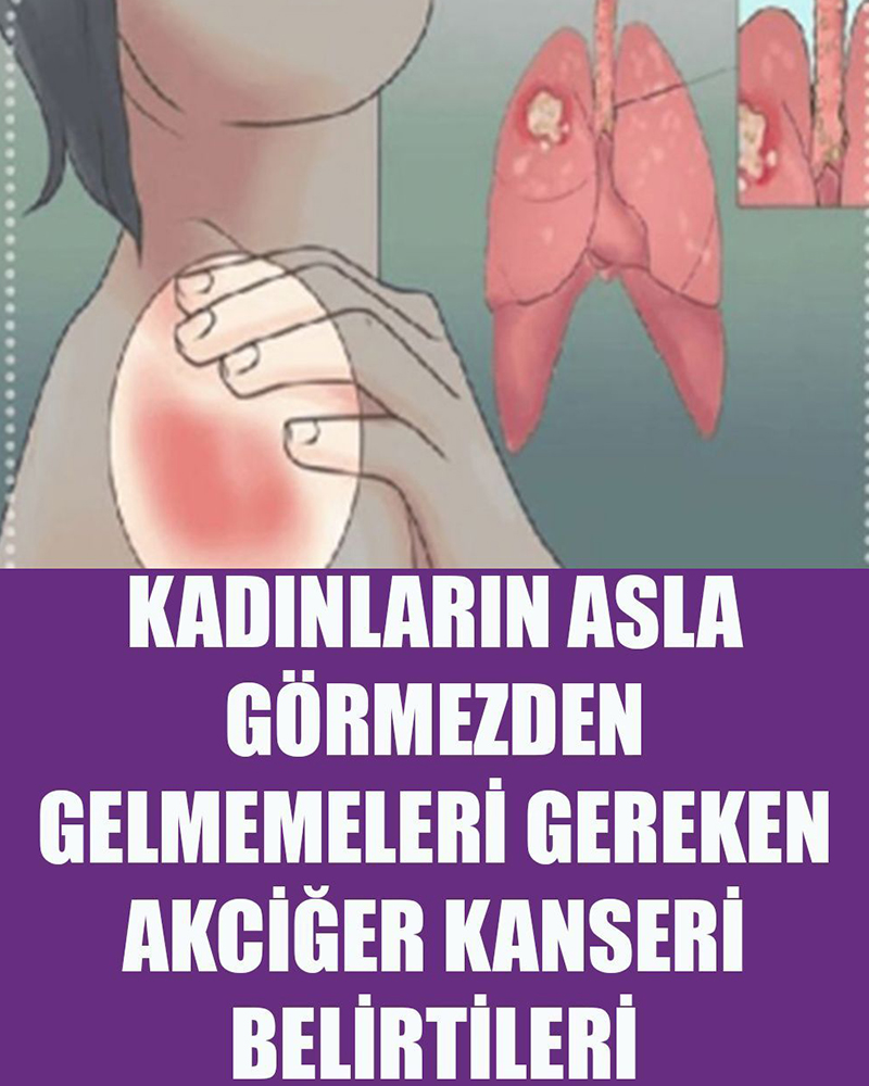 Kadınlarda belirtileri nelerdir - 1