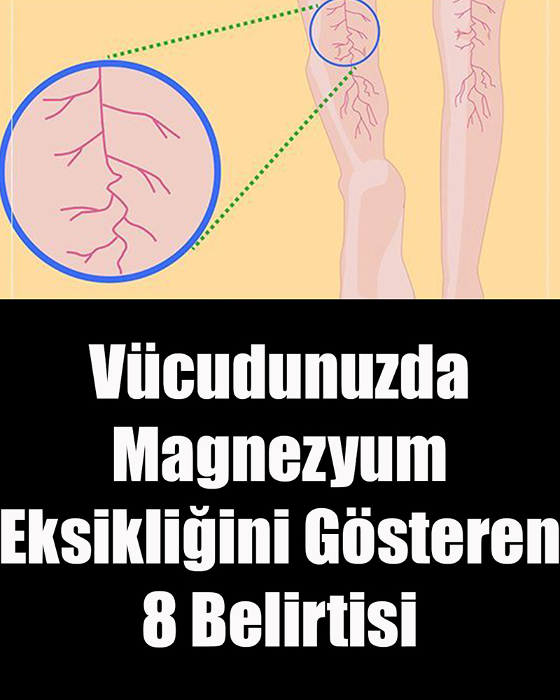 Vücudunuzda Magnezyum Eksikliğini Gösteren 8 Belirtisi - 1
