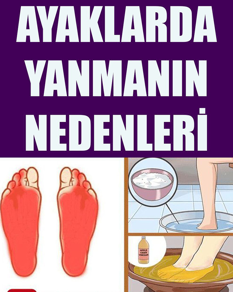 Ayaklarda Yanma Nedenleri - 1