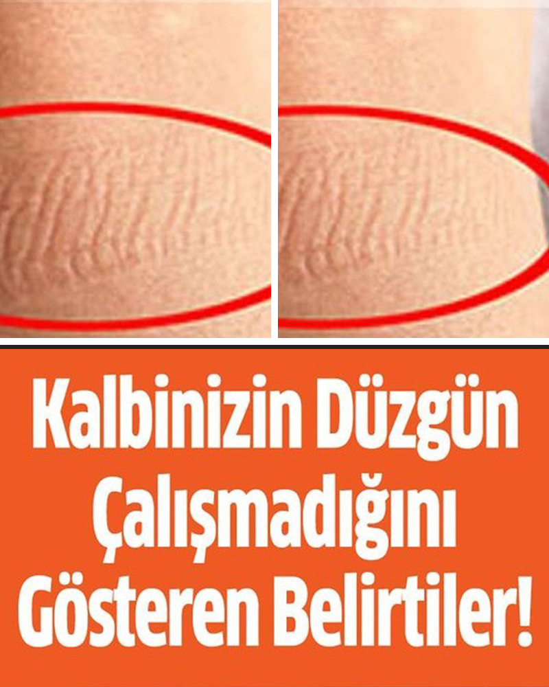 Kalbinizin düzgün çalışmadığını gösteren belirtiler - 1
