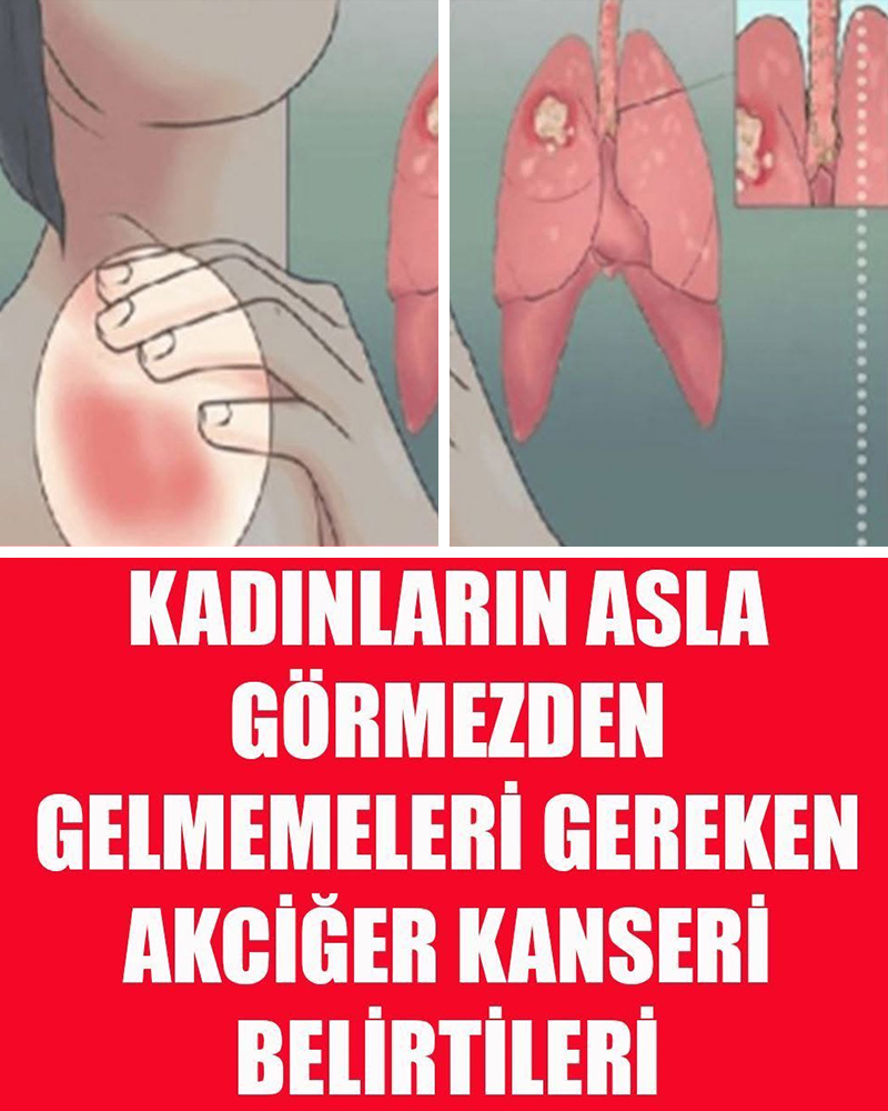 Kadınlarda belirtileri nelerdir - 1