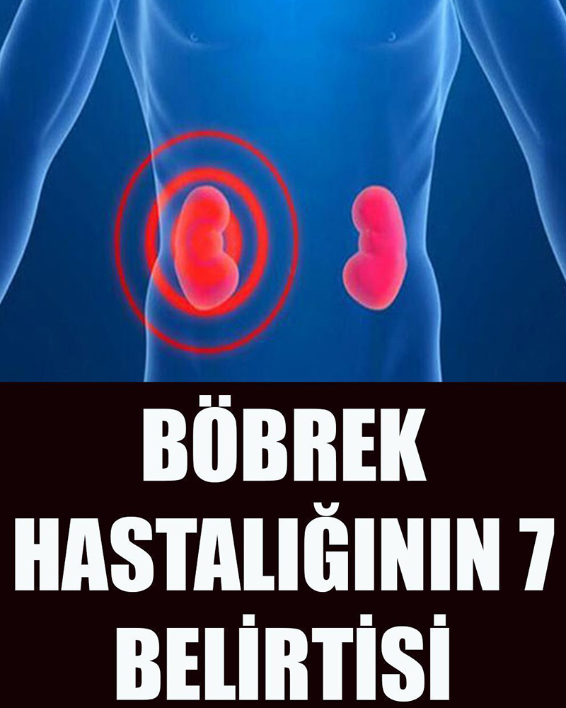 Böbrek Hastalığının 7 Belirtisi - 1