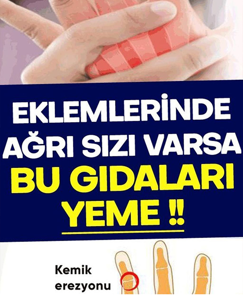Eklemlerinde ağrı olan var bu gıdaları tüketmesin - 1