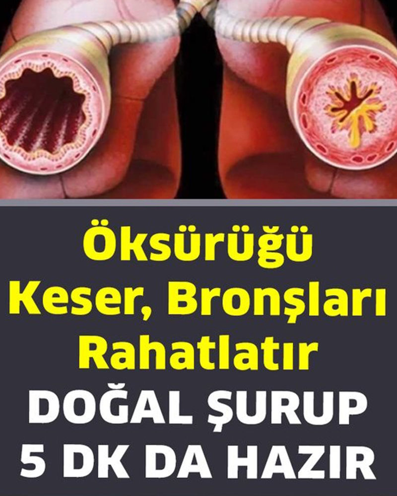 Öksürüğü Keser, Bronşları Rahatlatır Doğal Öksürük Şurubu Tarifi - 1