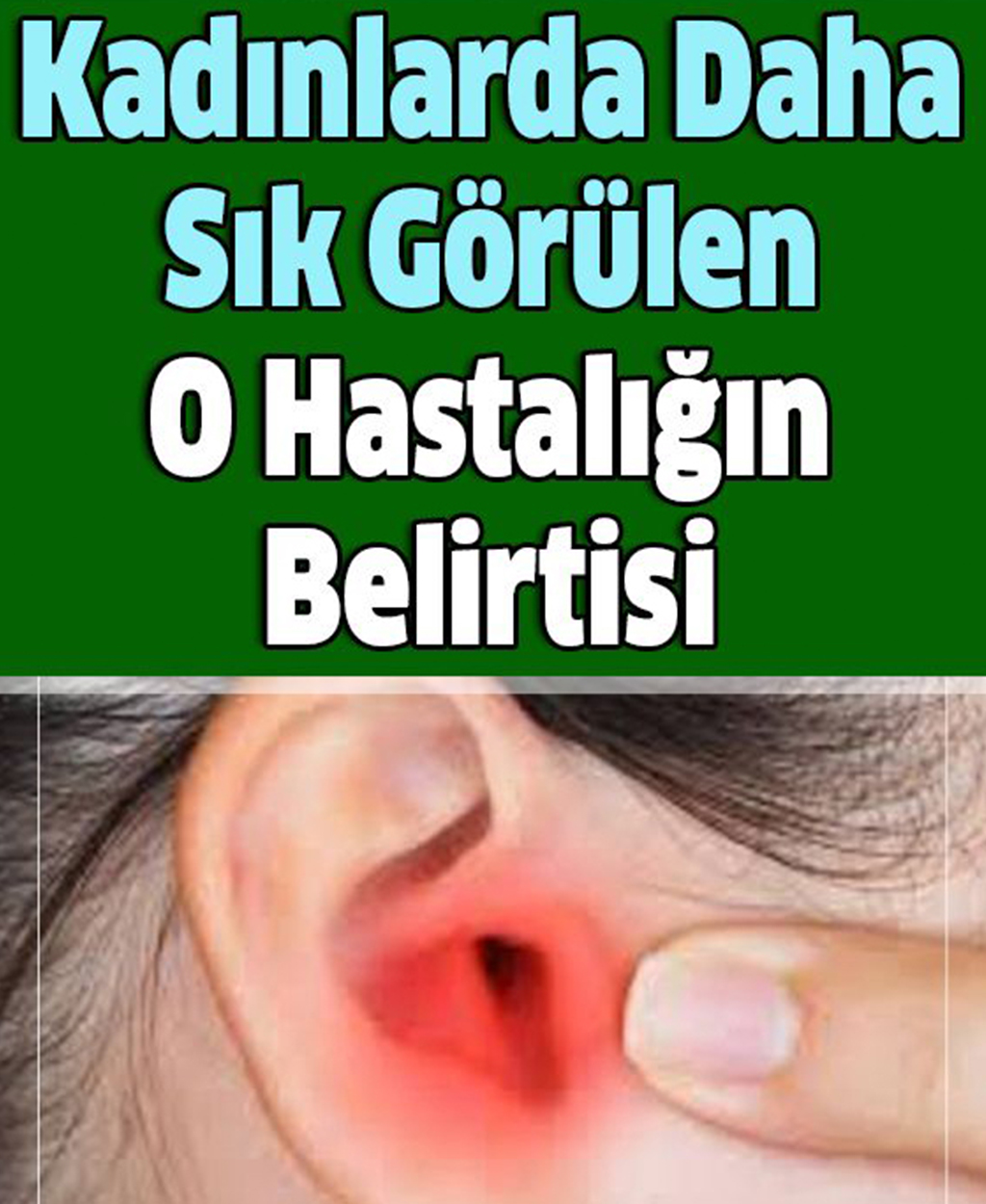 Kadınlarda Daha Çok Görülen O Hastalığın Belirtisi - 1