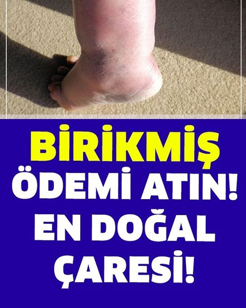 Birikmiş Ödemi Atmanın En Doğal Çaresi - 1