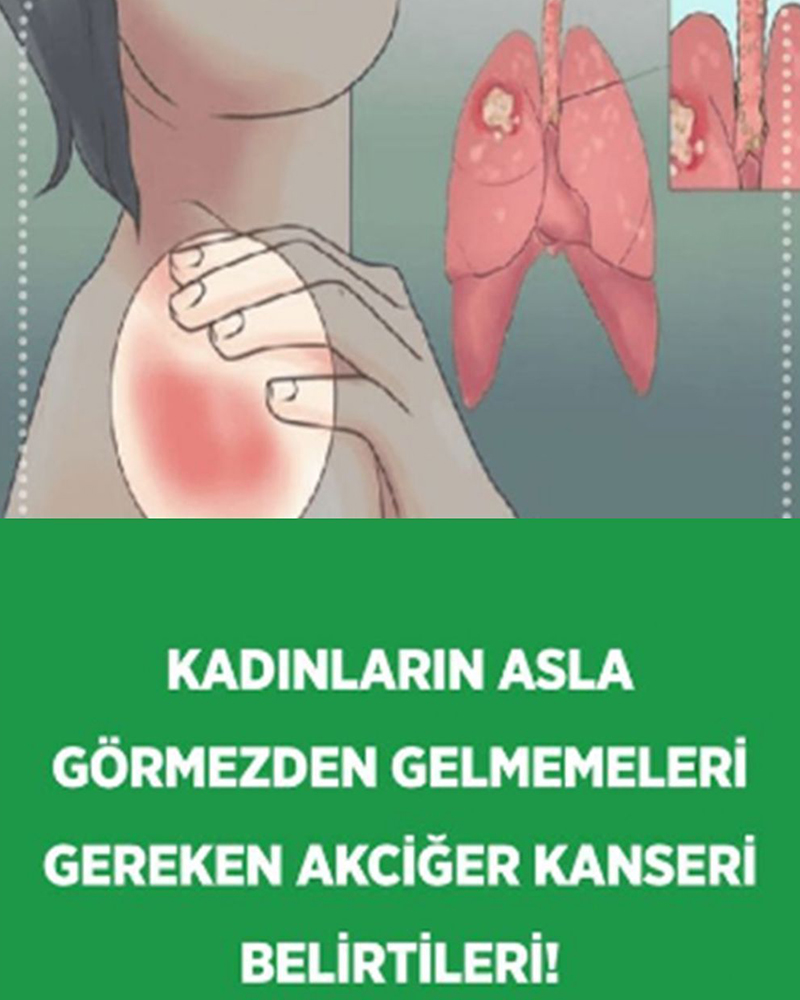 Kadınlarda belirtileri nelerdir - 1