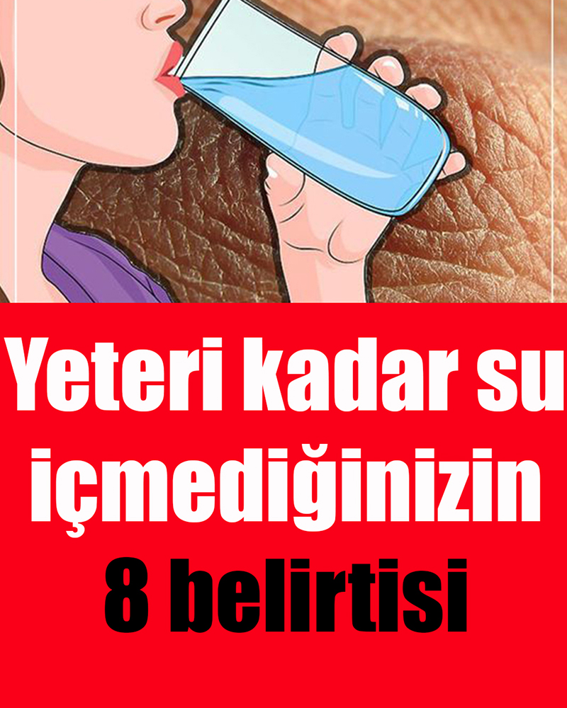 Yeteri kadar su içmediğinizin 8 belirtisi - 1