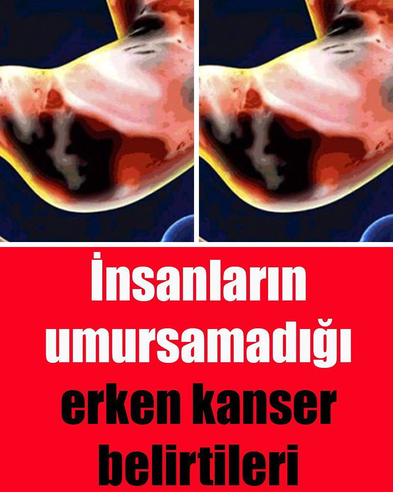 İnsanların umursamadığı erken bulguları - 1