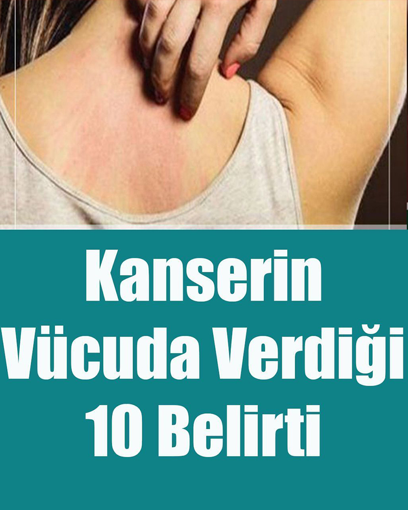 Kanserin Vücuda Verdiği 10 Belirti - 1