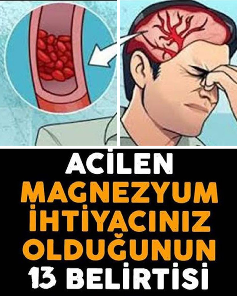 Magnezyum İhtiyacının Belirtileri - 1