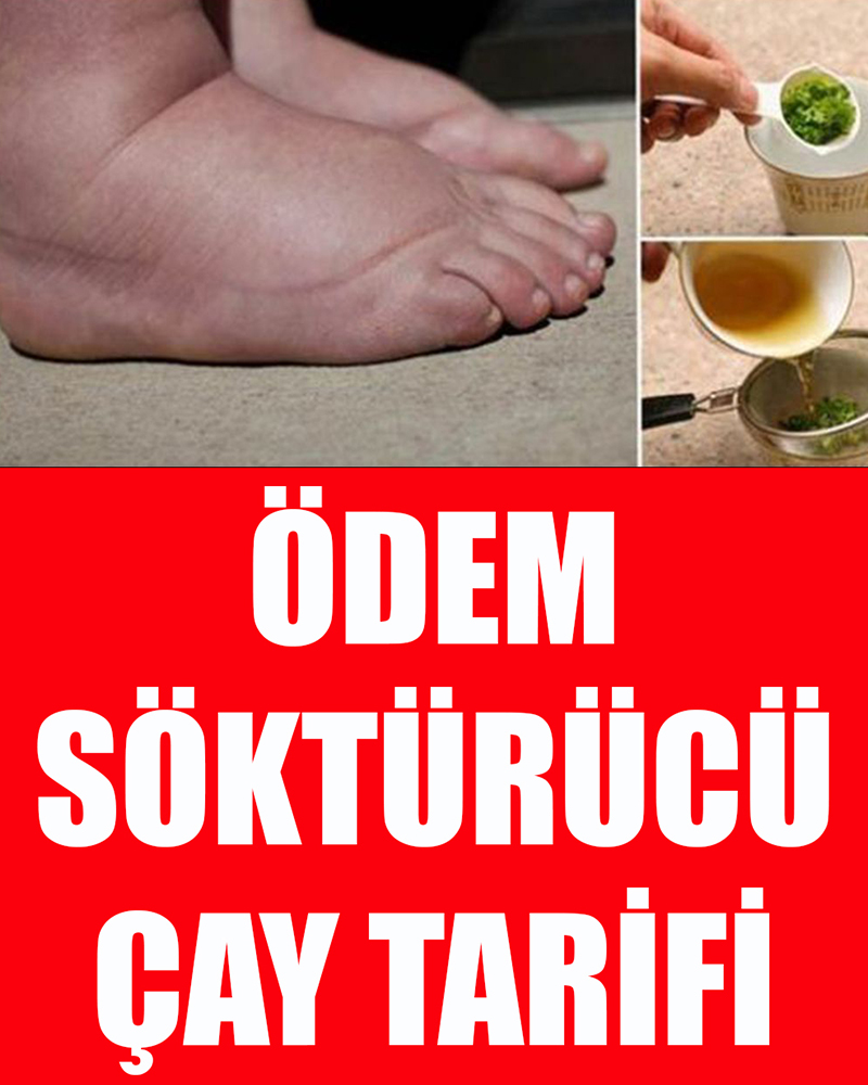 Ödem Söktürücü Çay Tarifi - 1