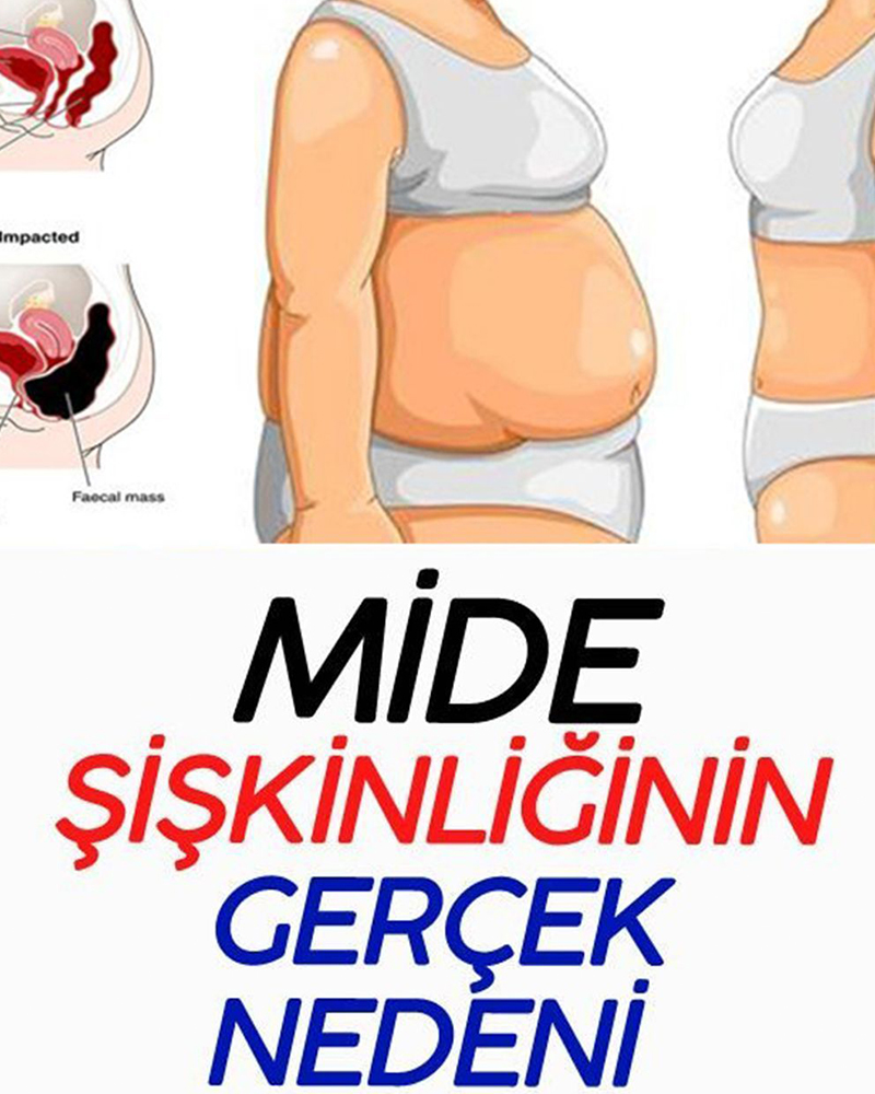 Mide Şişkinliğinin Gerçek Nedeni - 1