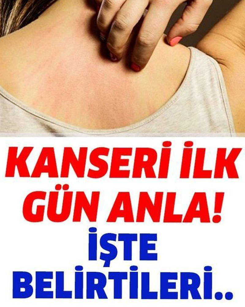 Kanser Olup Olmadığınızın Belirtileri Nelerdir? - 1