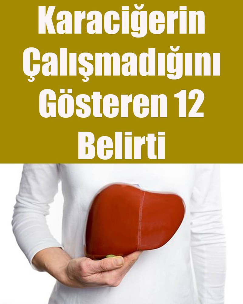 Karaciğerin Çalışmadığını Gösteren 12 Belirti - 1