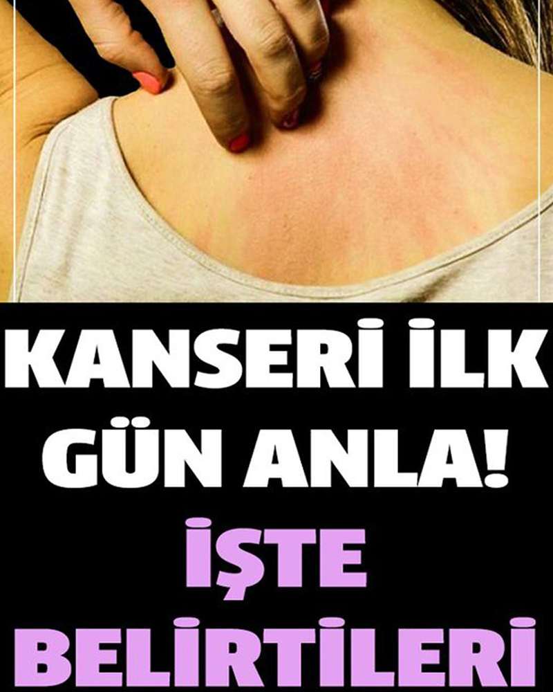 Hastalığına Ait İlk Belirtiler Nelerdir - 1