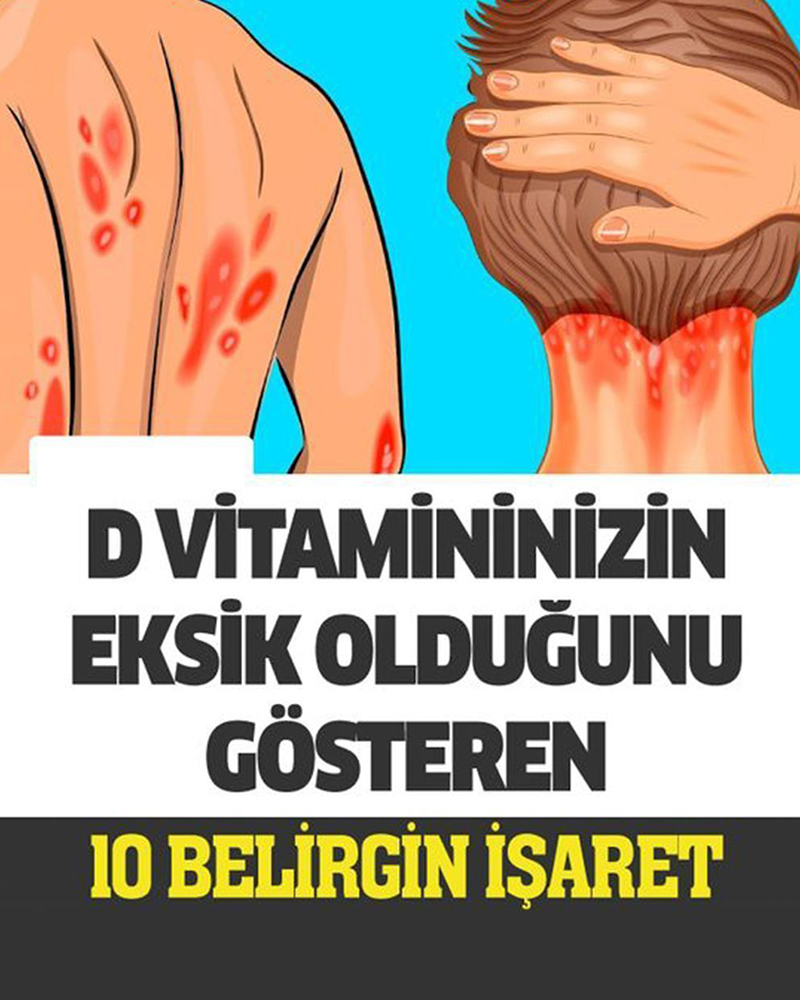 D Vitamini Eksikliğiniz Olduğunu Gösteren 10 Belirgin İşaret - 1