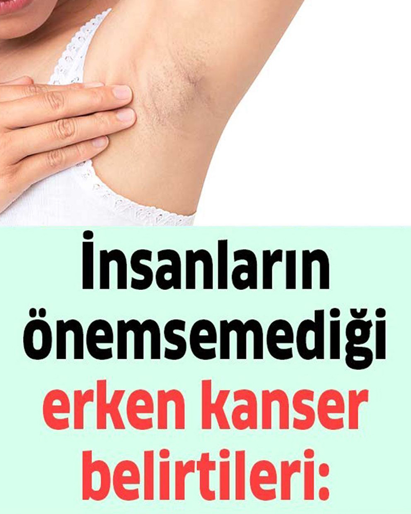 İnsanların umursamadığı erken bulguları - 1
