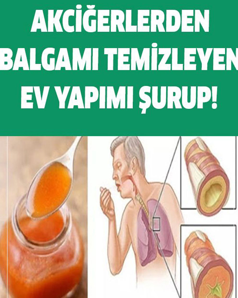 Akciğerlerden Balgam Temizlemede Kullanılan Yöntem - 1