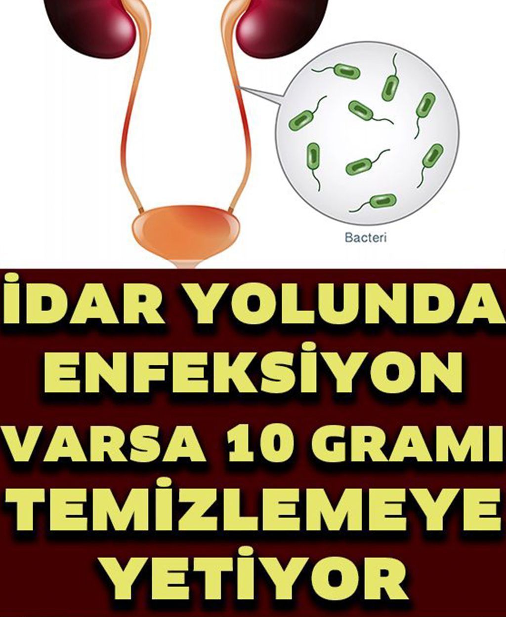 İdrar Yolu Enfeksiyonunu Geçiren 7 Doğal Yöntem - 1
