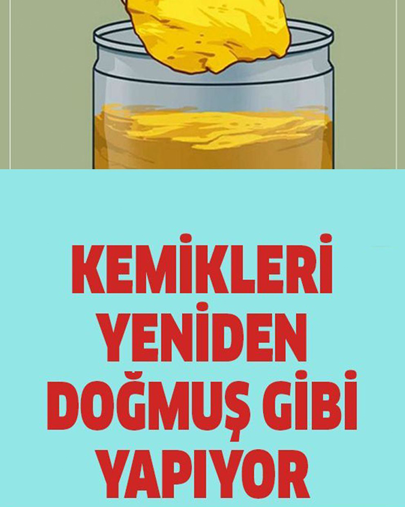 Kemikleri Yeniden Doğmuş Gibi Yapıyor - 1